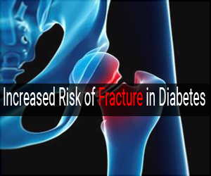 Diabetes increases risk of fractures in those who are frail, finds study
