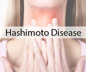 Vitamin D Supplementation decreases disease activity in Hashimotos Thyroiditis, finds study