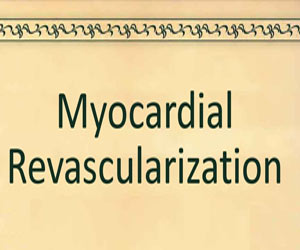 2018 ESC/EACTS Guidelines on Myocardial Revascularization released