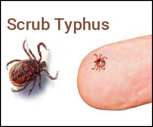 Early Use of Doxycycline in Scrub Typhus reduces complications