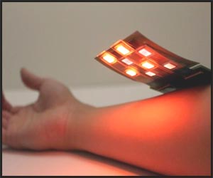 Wearable sensors mimic skin to help with wound healing process