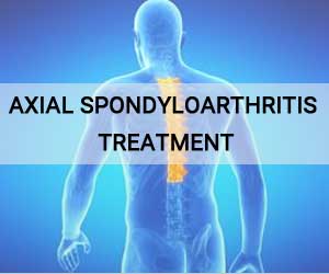 Secukinumab OK for treatment of axial spondyloarthritis: Findings from PREVENT Trial
