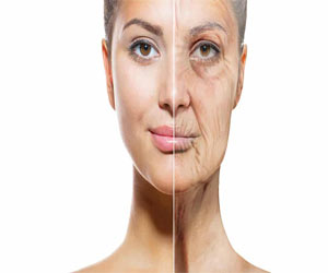 Bakuchiol - Herbal alternative of retinol for improving facial photoageing