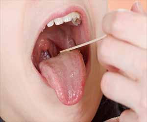 Single use laryngeal mask safe alternative for children undergoing adenotonsillectomy