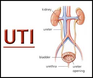 New rapid, cheaper, portable smartphone based test for UTIs