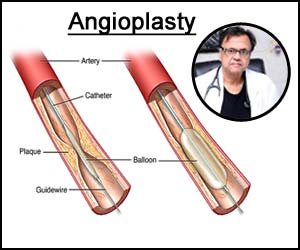 Primary questions asked before deciding for primary angioplasty in acute myocardial infarction patients