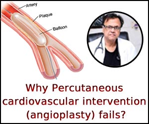 Perspective: Why Percutaneous cardiovascular intervention (angioplasty) fails?