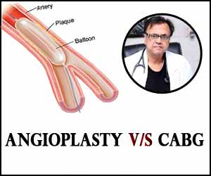 Angioplasty as an alternative to CABG surgery or medical therapy in diabetes. when? and to whom?