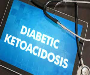 Consensus report on risk management of diabetic ketoacidosis with SGLT inhibitors
