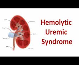 Haemolytic Uremic Syndrome Revisited