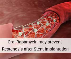 Oral Rapamycin may prevent restenosis after Coronary bare metal Stent implantation: JACC
