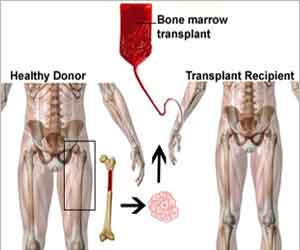 Its time to demystify Bone Marrow Transplant Therapy- Dr Rahul Bhargava