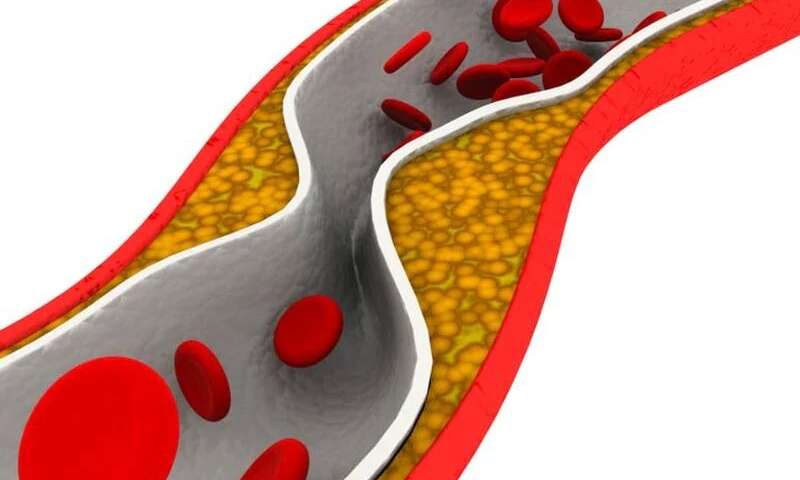 PCR statement on Interventions with paclitaxel drug-coated balloons