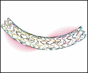 Dual drug delivery system may make heart stents safer