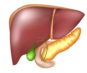 Islet cell transplant key to long term blood sugar control without insulin in diabetes