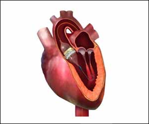 Fortis Malar doctors successfully replace dysfunctional aortic valve by TAVR