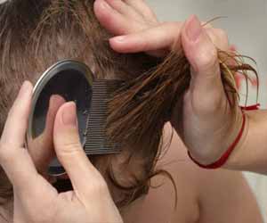 Washing hair with custard apple seeds for lice removal can cause toxic keratitis: Study