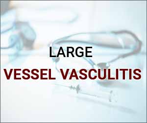 MRI and PET combo improves detection of vasculitis abnormalities, finds study