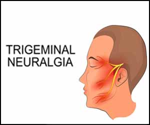 Diagnosis and management of trigeminal neuralgia: EAN Guideline