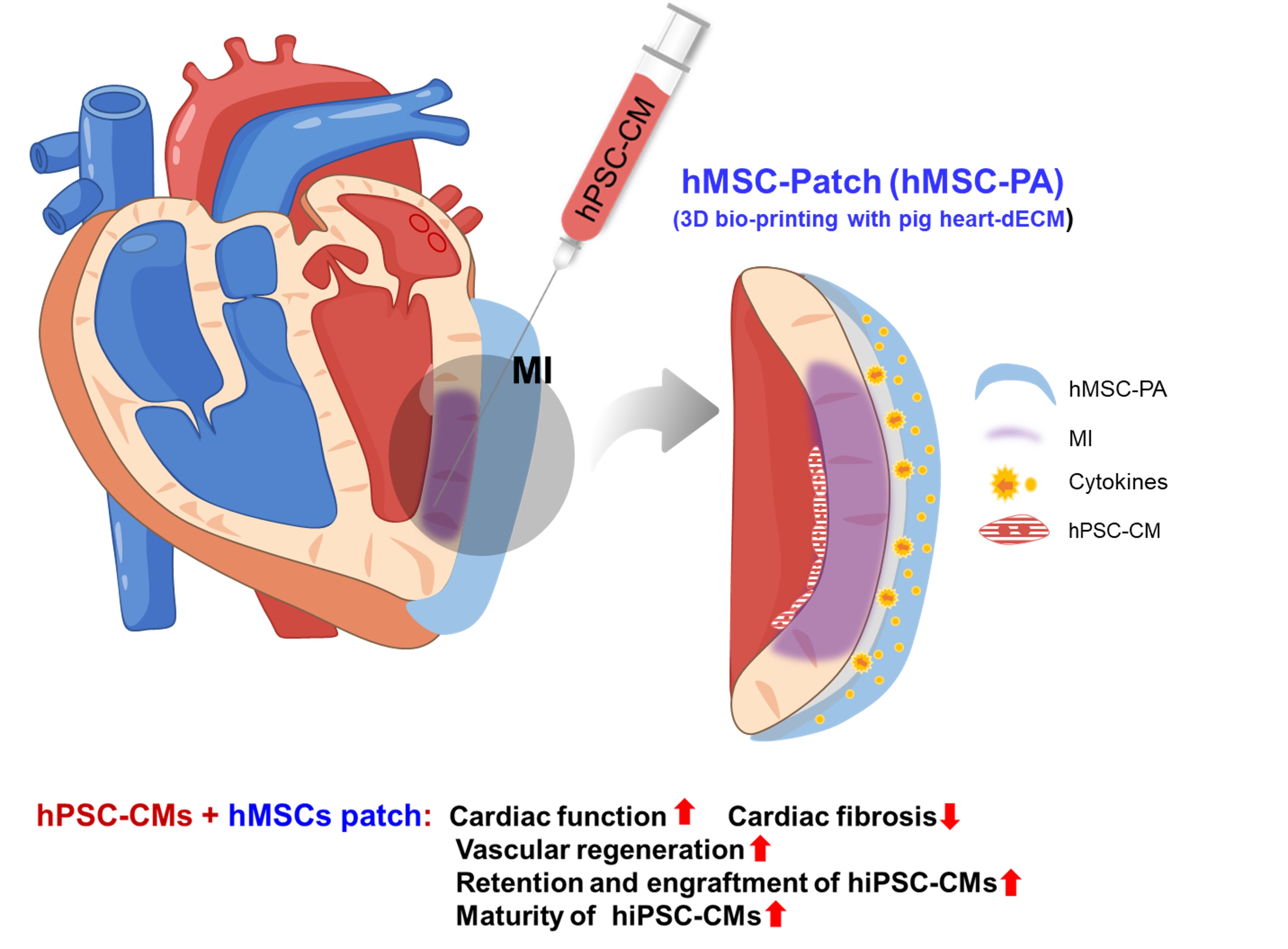 Scientists develop Novel Stem Cell Therapy for Cardiac Regeneration in MI