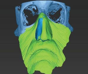 Groundbreaking Imaging Technology empowers Practitioners to reconstruct face: Case study