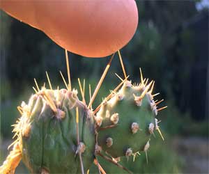 First successful removal of cactus spines in a patient: A Case Report