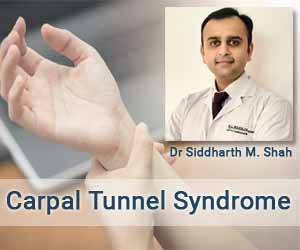 Understanding Carpal Tunnel Syndrome and its impact- Dr Siddharth M. Shah