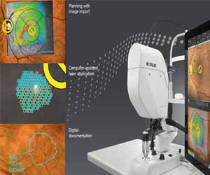 Navigated retinal laser therapy more effective than conventional slit-lamp lasers