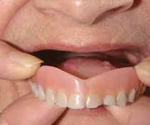 False teeth should be removed before general anesthetic procedure: BMJ Case Report
