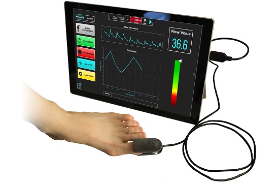 FDA grants clearance to new Blood Flow Monitoring Device for peripheral artery disease
