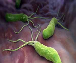 Nanocapsules of turmeric compound may help treat H Pylori infection, finds study
