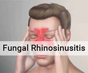 Fungal Rhinosinusitis: AIIMS 2019 guidance