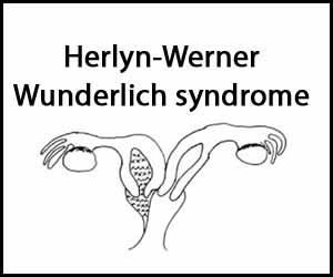 Herlyn-Werner-Wunderlich syndrome, Image