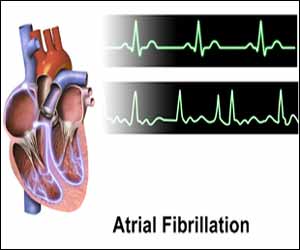 Height is causal risk factor for Atrial Fibrillation shows Penn Medicine study