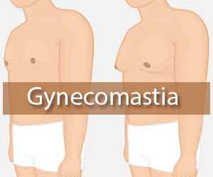 Gynecomastia evaluation and management- EAA clinical practice guidelines