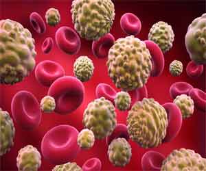 Researchers closer to finding treatment for incurable form of blood cancer