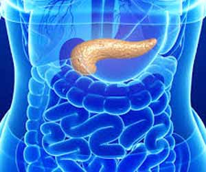 New Virtual biopsy may immediately diagnose precancerous pancreatic cysts
