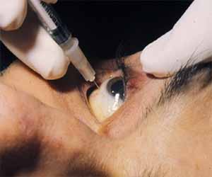 Intravitreal injection of ocriplasmin resolves vitreomacular traction, improves vision