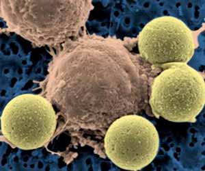 Investigational drug as effective as CAR T cell therapy in Lymphoma