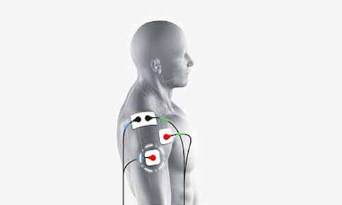 FDA clears Medacta's MyShoulder placement guides