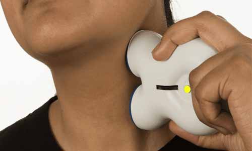 Vagal nerve stimulation improves symptoms in gastroparesis patients